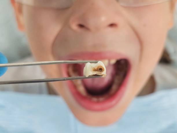 Best Root Canal Emergency Dentist  in Wolf Trap, VA
