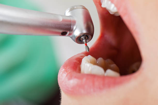 Best Dentist for Tooth Abscess  in Wolf Trap, VA